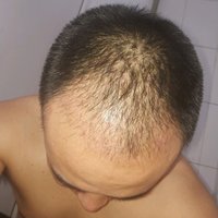 發(fā)際線用戶圖片