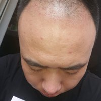 發(fā)際線用戶圖片