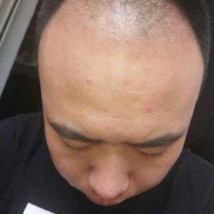 发际线分享社区