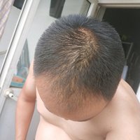 發(fā)際線用戶圖片