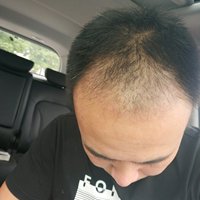 生發(fā)養(yǎng)護(hù)用戶圖片
