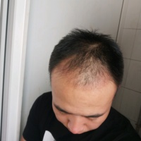 發(fā)際線用戶圖片