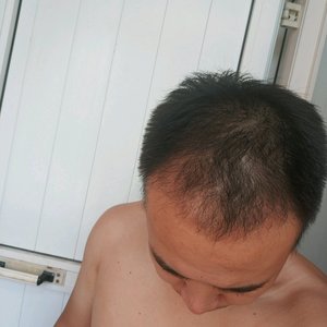 发际线分享社区