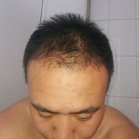 發(fā)際線用戶圖片