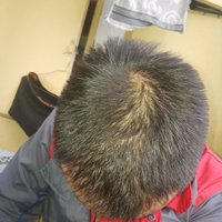 發(fā)際線用戶圖片