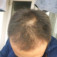 發(fā)際線用戶圖片