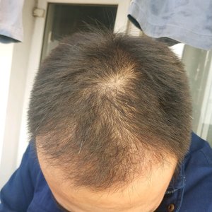 发际线分享社区