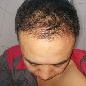 发际线分享社区