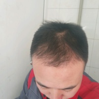 發(fā)際線用戶圖片