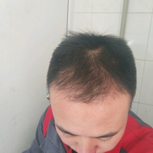 发际线分享社区