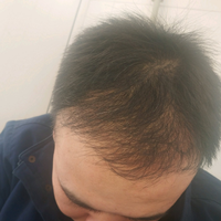 發(fā)際線用戶圖片