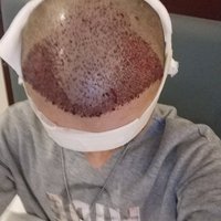 發(fā)際線用戶圖片