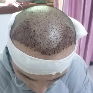 发际线分享社区
