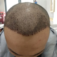 發(fā)際線用戶圖片