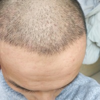 發(fā)際線用戶圖片