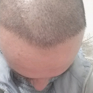 发际线分享社区