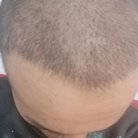 發(fā)際線用戶(hù)圖片