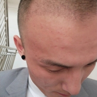 發(fā)際線用戶(hù)圖片
