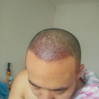 發(fā)際線用戶(hù)圖片
