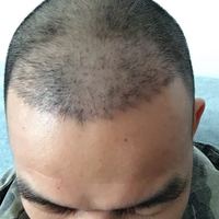 發(fā)際線用戶(hù)圖片