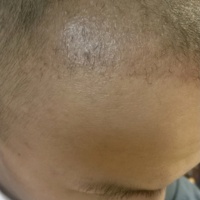 發(fā)際線用戶(hù)圖片