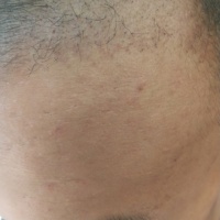發(fā)際線用戶圖片
