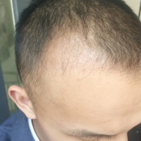 發(fā)際線用戶圖片