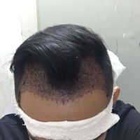發(fā)際線用戶圖片