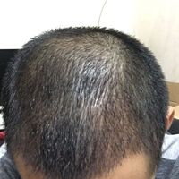 發(fā)際線用戶圖片