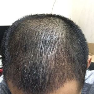 发际线分享社区