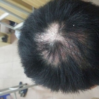 失敗修復(fù)用戶圖片