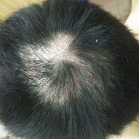 失敗修復(fù)用戶圖片