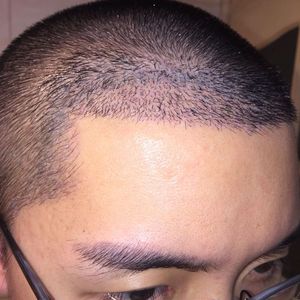 发际线分享社区