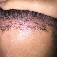 發(fā)際線用戶圖片