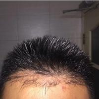 發(fā)際線用戶圖片