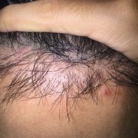 發(fā)際線用戶圖片