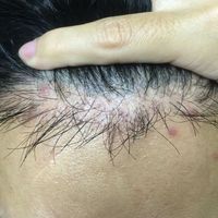 發(fā)際線用戶圖片