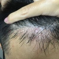 發(fā)際線用戶圖片