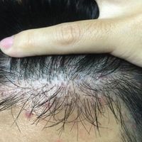 發(fā)際線用戶圖片