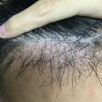 發(fā)際線用戶圖片