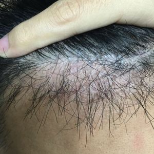 发际线分享社区