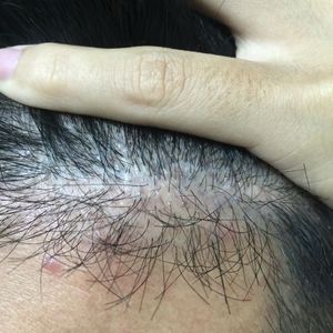 发际线分享社区