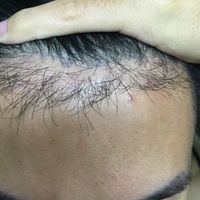 發(fā)際線用戶圖片