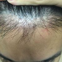 發(fā)際線用戶圖片