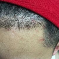 發(fā)際線用戶圖片
