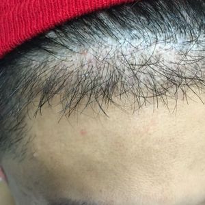 发际线分享社区