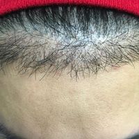 發(fā)際線用戶圖片