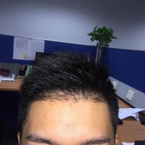 发际线分享社区