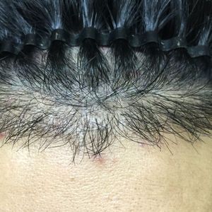 发际线分享社区