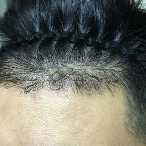 发际线分享社区
